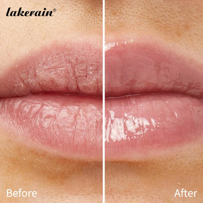 Luxe Lip Renewal Balm™